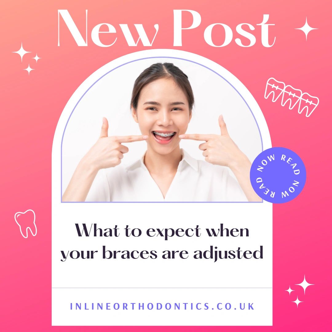 What to expect when your braces are adjusted.